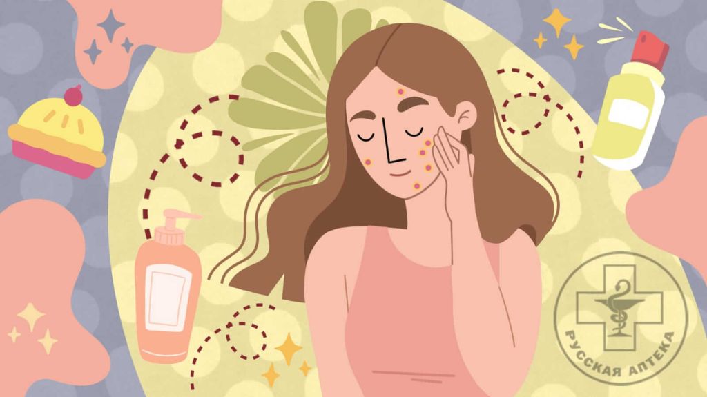 КАК ИЗБАВИТЬСЯ ОТ АКНЕ?