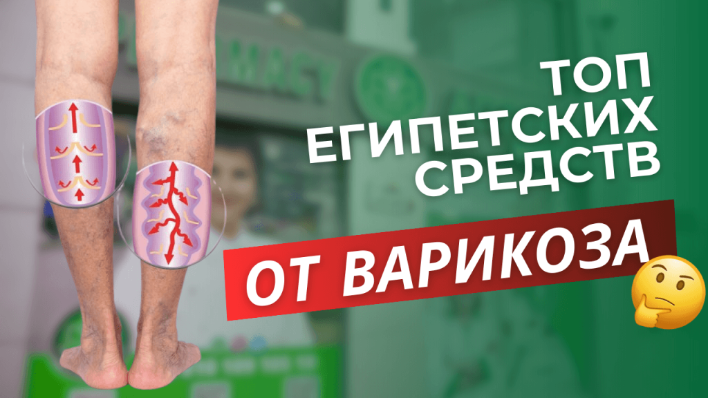 Как избавиться от тяжести в ногах и укрепить сосуды при варикозе?