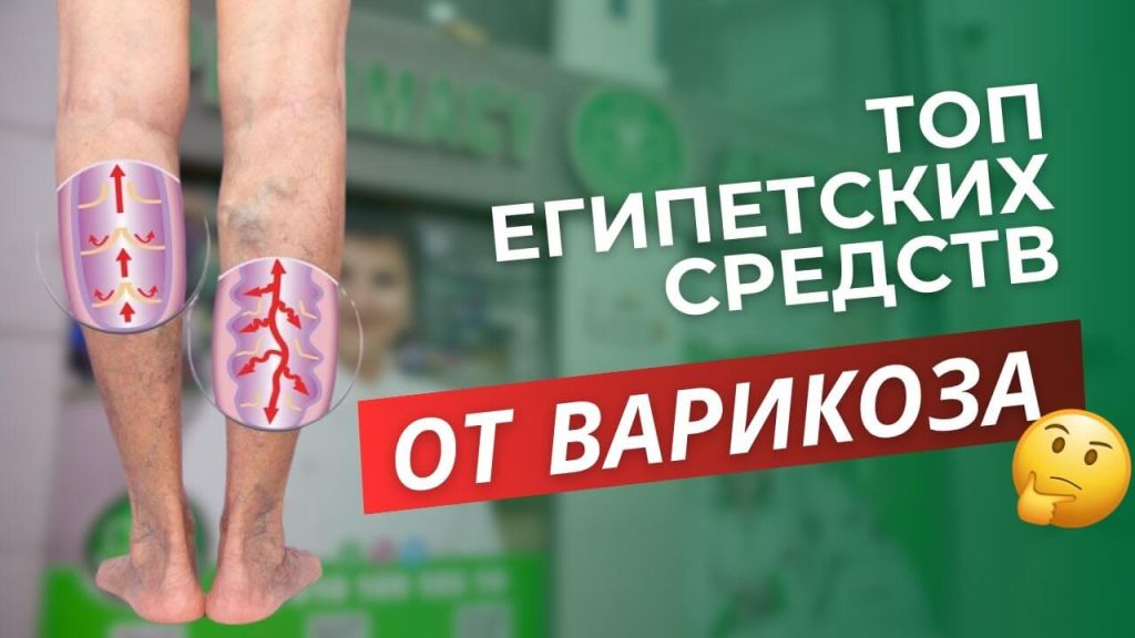 How to get rid of heaviness in the legs and strengthen the blood vessels with varicose veins?
